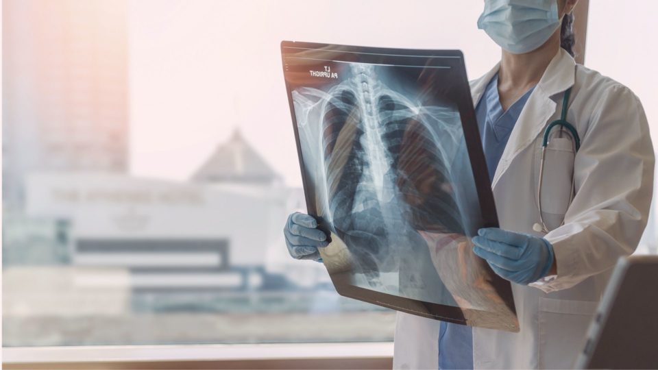 Análise de radiografia dos pulmões de um paciente (Foto: Reprodução/Bigstock)