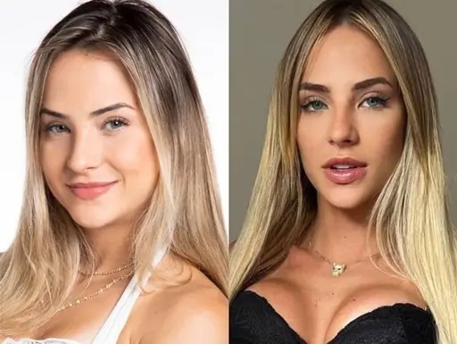 Gabi Martins antes e depois dos procedimentos estéticos - foto(reprodução/Popline) Lorena Bueri