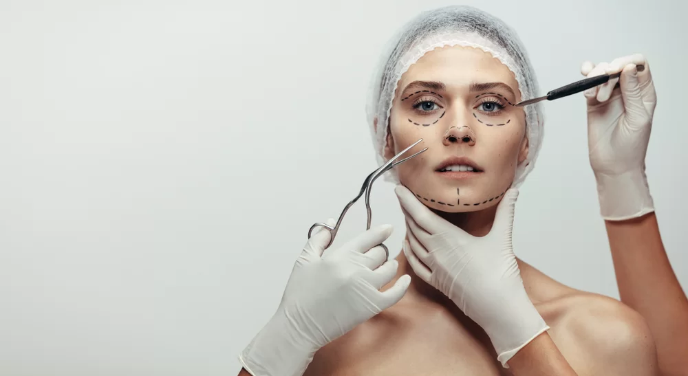 Paciente com marcações no rosto para procedimento de lifting facial.