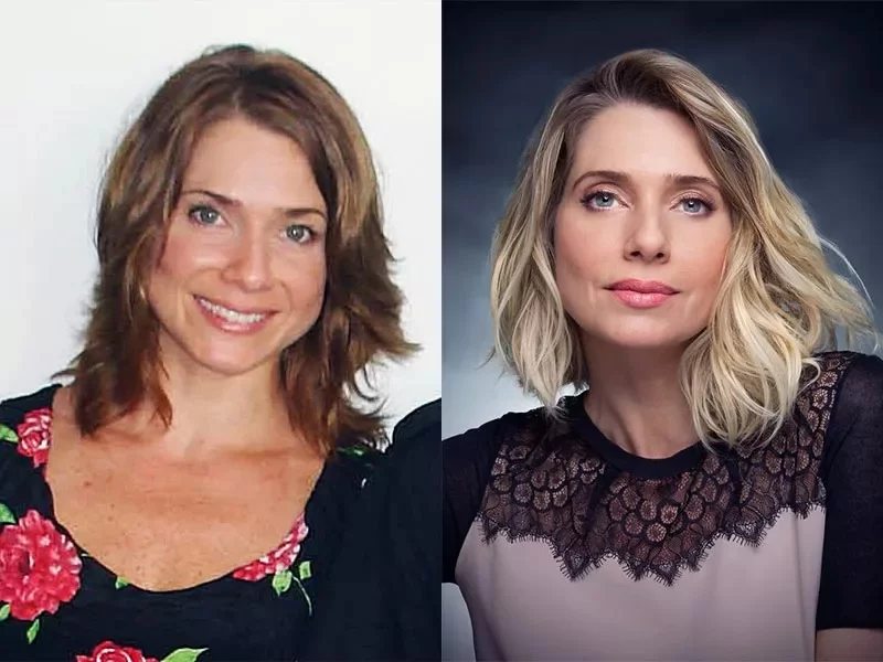 Antes e depois do lifting facial da atriz Letícia Spiller (Foto: Reprodução/Plastica dos Sonhos)