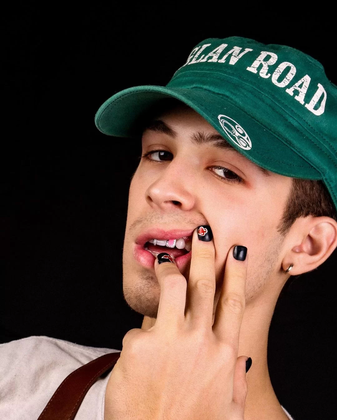 João Guilherme (Foto: reprodução/Instagram/@elementsjoiadental) Lorena Bueri