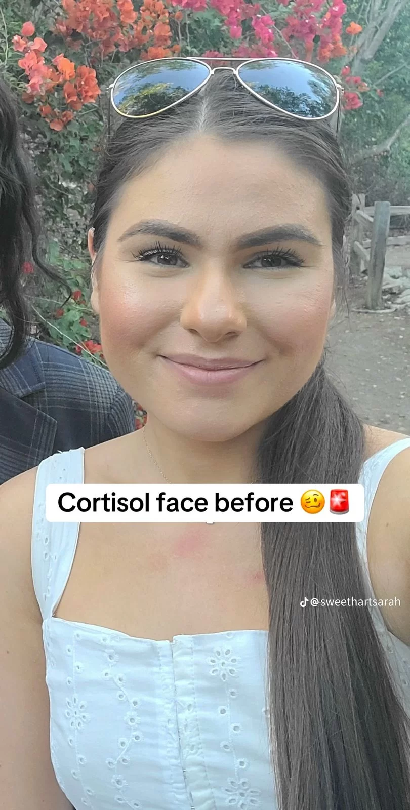 A influencer Sarah compartilhando seu 'antes e depois' do 'cortisol face' (Foto: reprodução/Tiktok/@sweethartsarah) Lorena Bueri