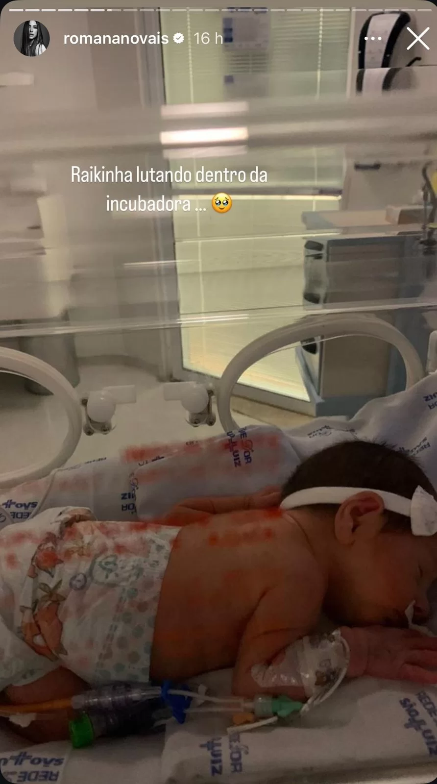 Stories compartilhados por Romana Novais sobre o nascimento prematuro da filha (Fotos: reprodução/Instagram/@romananovais) Lorena Bueri