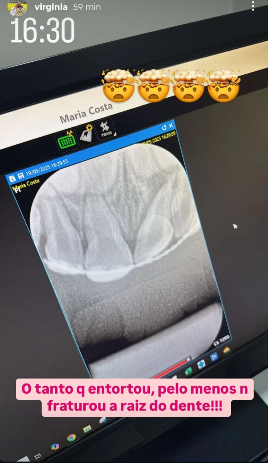 Virginia mostra o Raio-x dos dentes de sua filha  (Foto: reprodução/Instagram/@virginia) Lorena Bueri