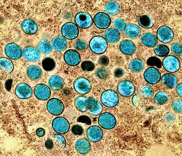 imagem de laboratório do vírus da varíola do macaco monkeypox