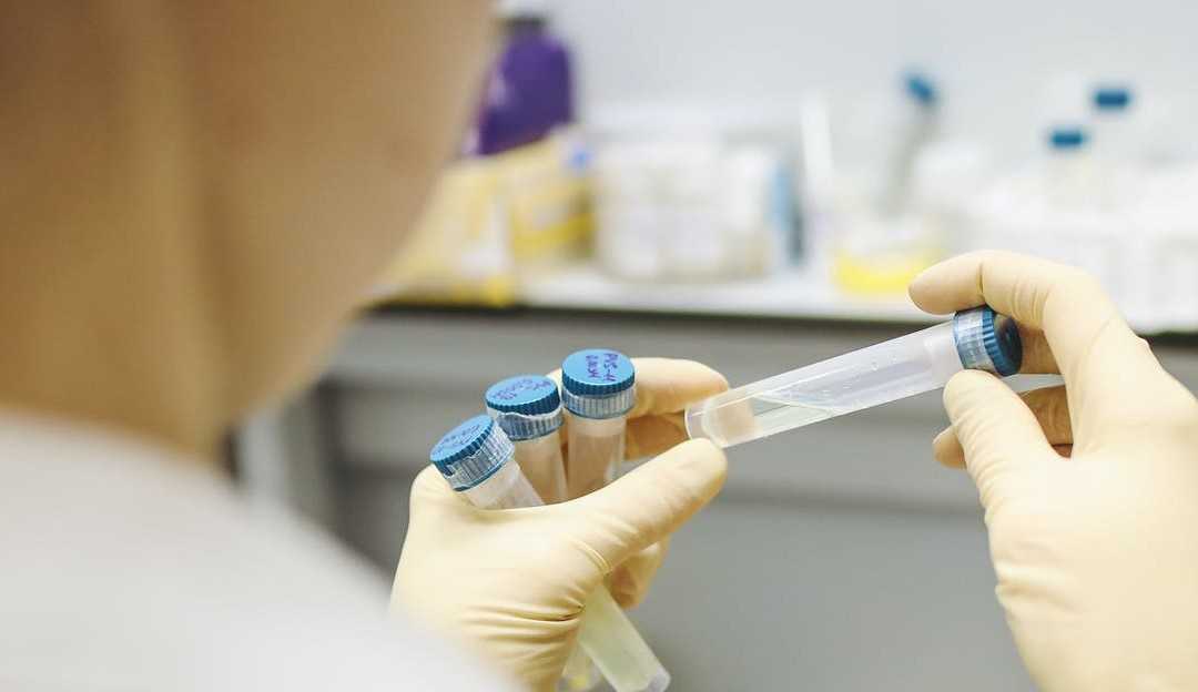 Fiocruz aguarda pedido do Ministério da Saúde para entregar 15 milhões de testes de covid