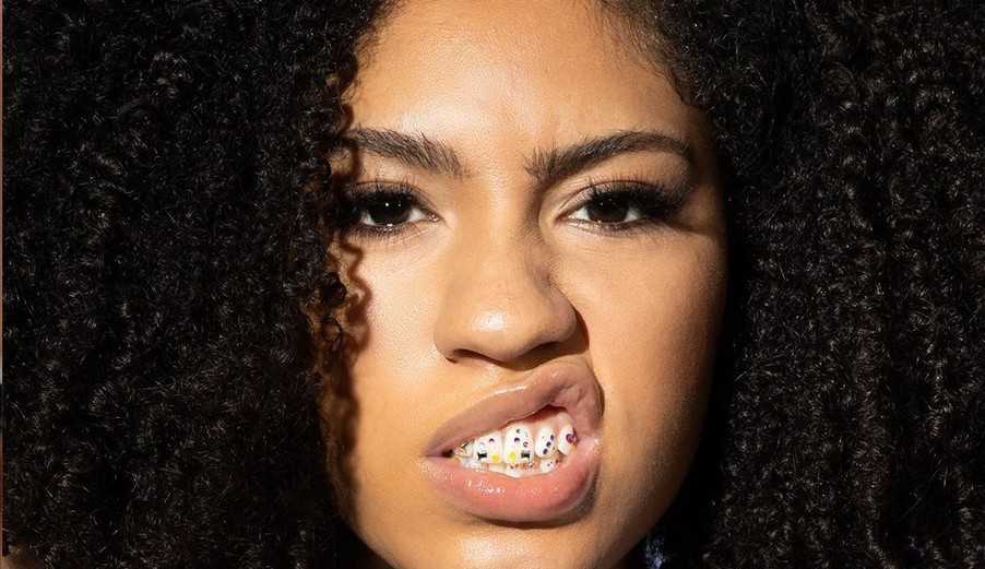 Piercing no dente é a mais nova tendência de 2022 Lorena Bueri