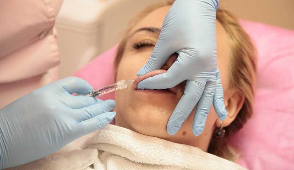 Preenchimento labial: procedimento que ganhou destaque entre famosos Lorena Bueri
