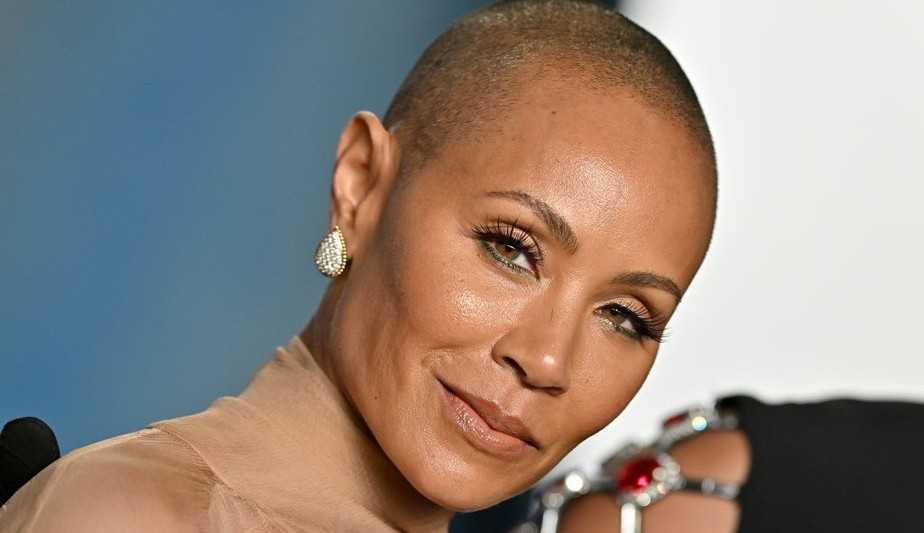 Médicos explicam a alopecia, doença de Jada Smith