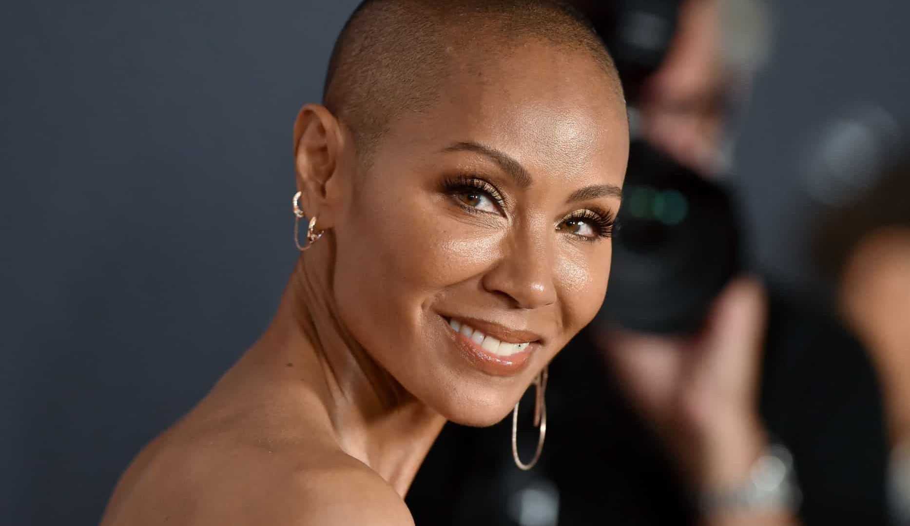 Alopecia: entenda o distúrbio apresentado por Jada Smith