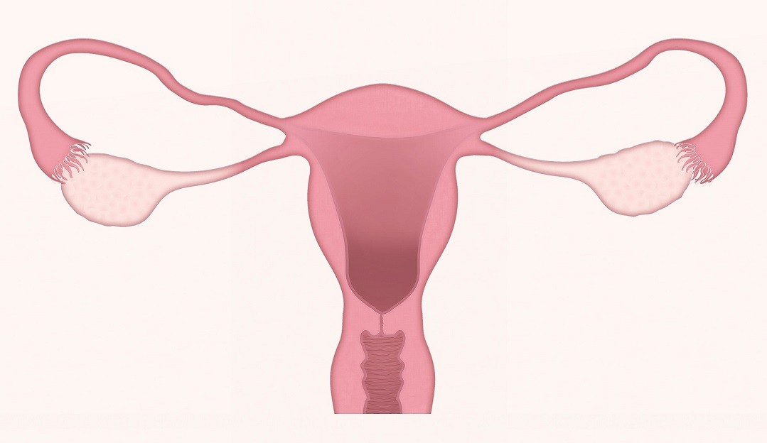 Endometriose: entenda o que é, quais são os sintomas e tratamento Lorena Bueri