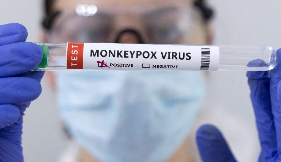 Aumento no número de casos de varíola dos macacos estimula busca por imunização