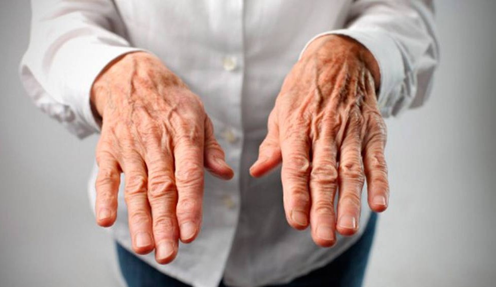 Levantamento da OMS mostra aumento de casos da doença de Parkinson no mundo