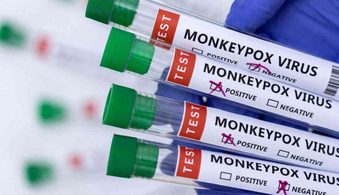 Pesquisadores afirmam que vírus da varíola dos macacos é encontrado em sêmen