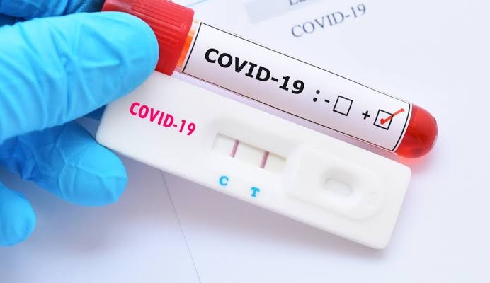Testes de Covid-19 positivos registra o maior número em 17 semanas