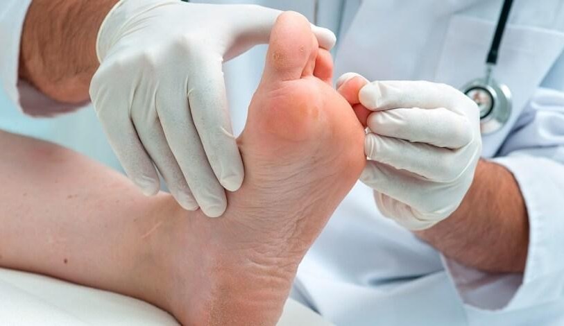 Diabetes pode ser identificada pela aparência dos pés