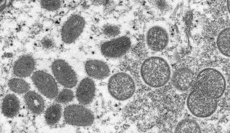 EUA intensifica a vacinação contra a varíola dos macacos Lorena Bueri