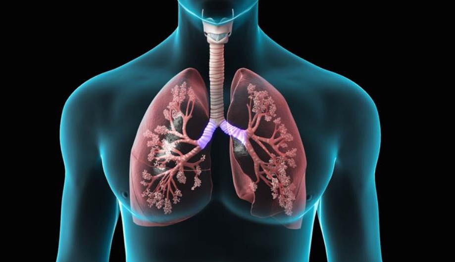 Doença pulmonar obstrutiva crônica: entenda o que é a DPOC e quais são seus riscos Lorena Bueri