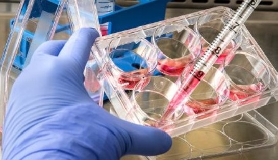 Casos de varíola dos macacos nos EUA continuarão crescendo até agosto, afirmam especialistas Lorena Bueri