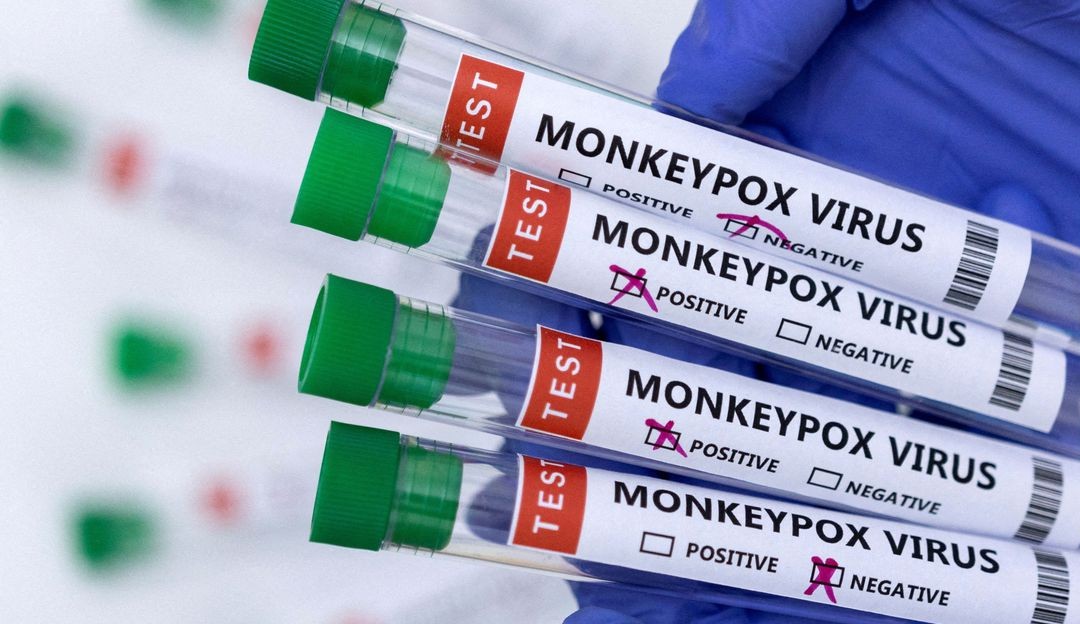 União Europeia garante mais 54 mil doses contra a varíola dos macacos