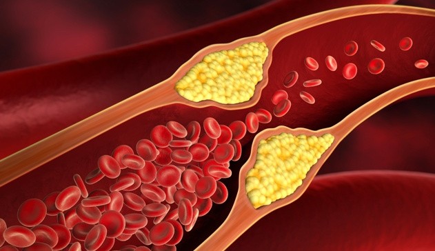 Entenda o que é o colesterol e como controlar os seus níveis