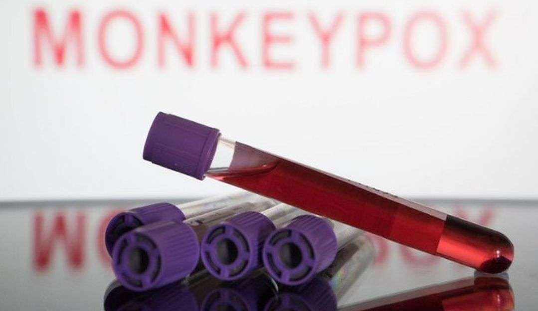 ANS determina que planos de saúde devem cobrir o teste para varíola dos macacos
