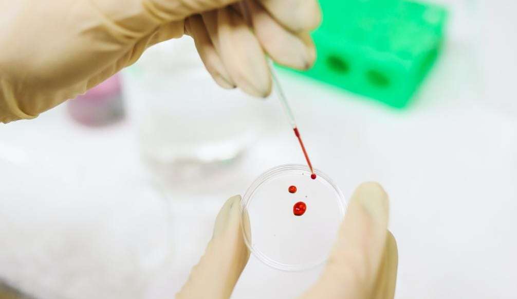 Pesquisadores enfatizam que fungos no sangue pode ajudar a identificar o câncer