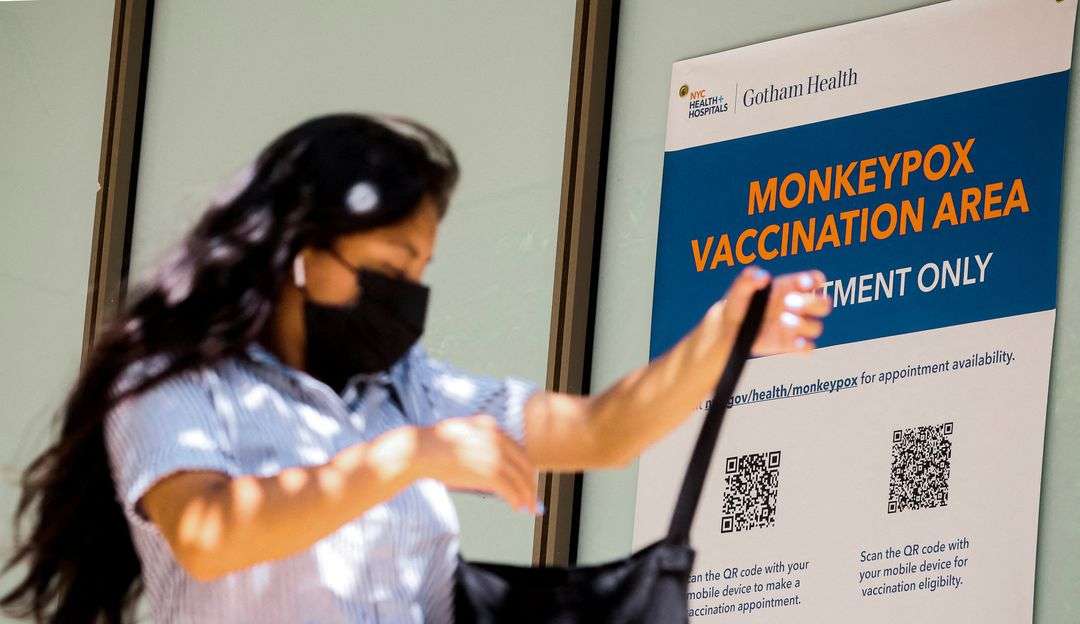 Estudo aponta que varíola do macaco pode ser fatal para quem possui sistema imunológico baixo Lorena Bueri