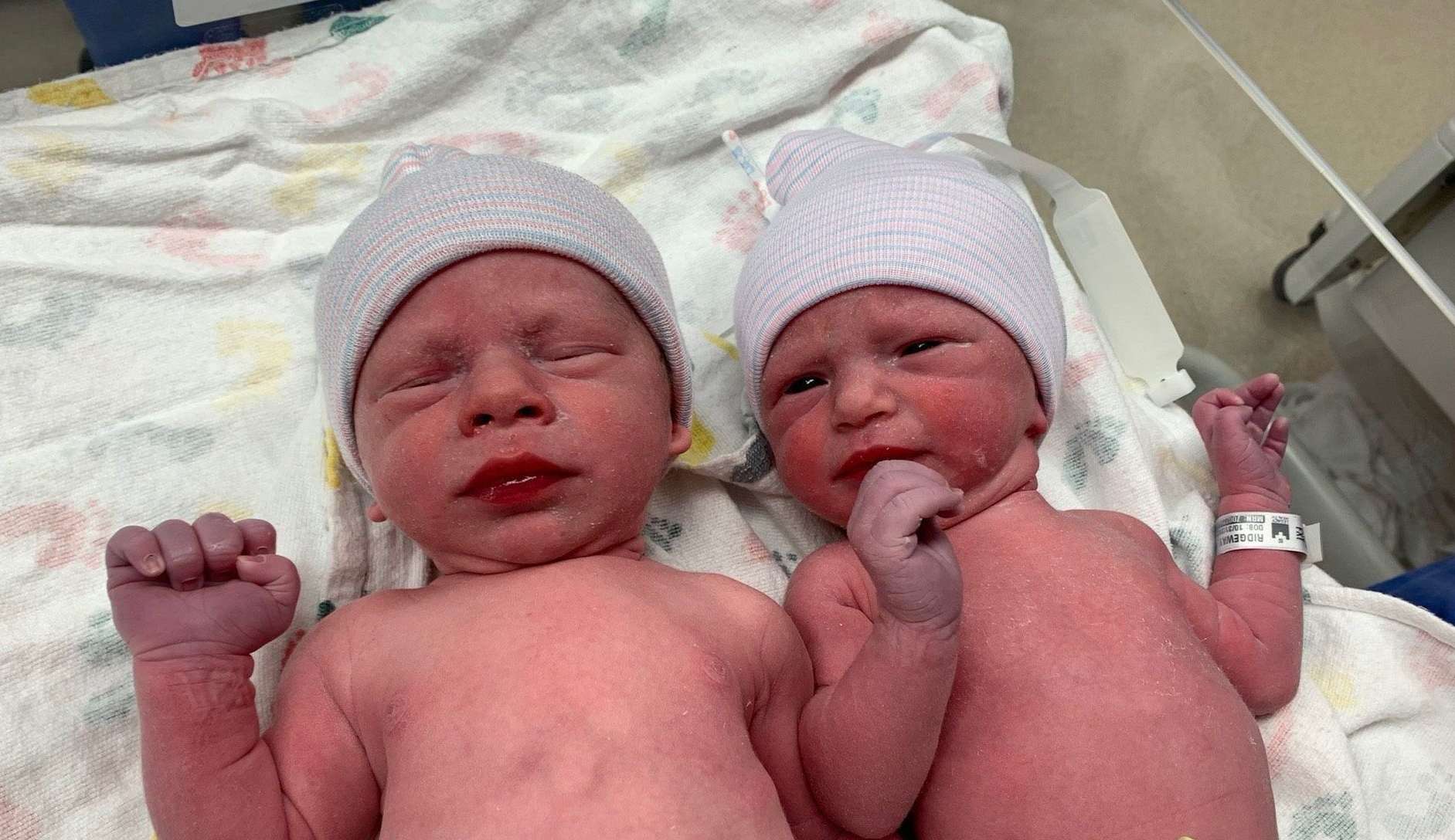 Gêmeos nascem de embriões que foram congelados há 30 anos e quebra recorde