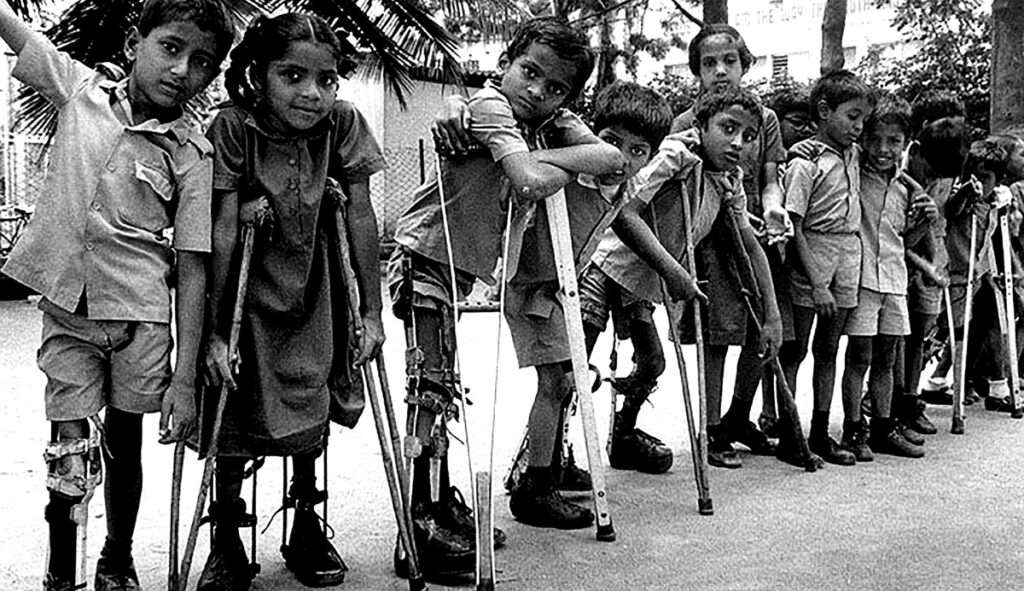 Poliomielite volta a assustar o Brasil