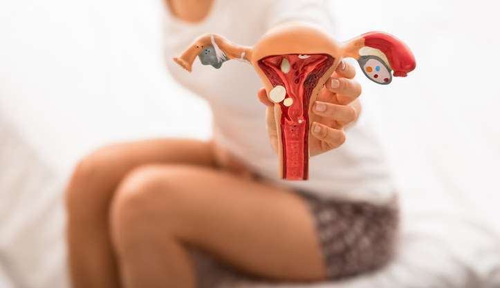 Conscientização sobre endometriose: Diagnóstico precoce é o principal aliado da paciente 