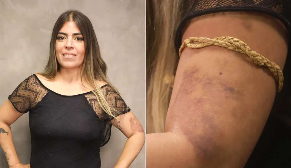Bruna Surfistinha denuncia agressão do ex- marido Lorena Bueri