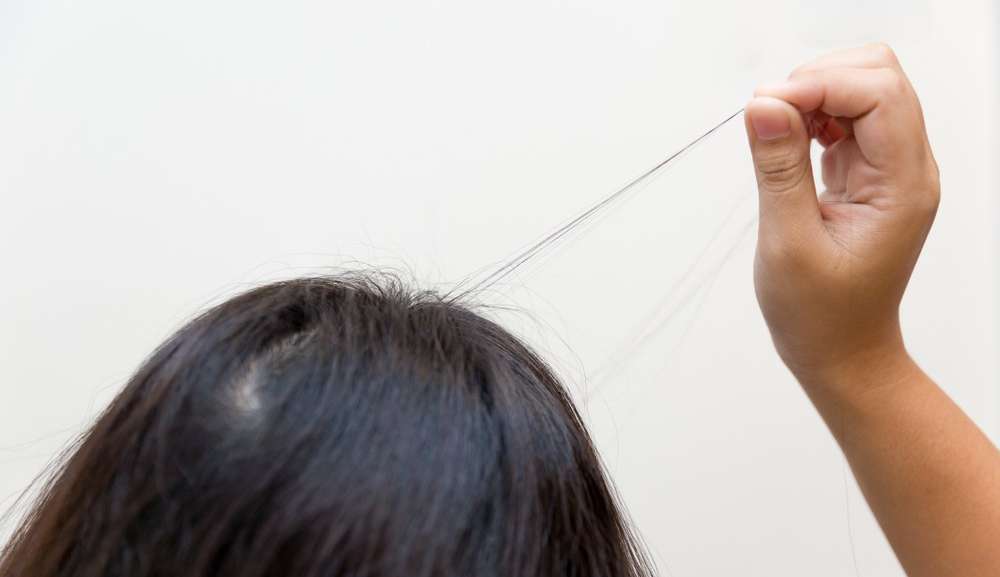 Hábitos de arrancar pelos do corpo e fios de cabelo pode estar relacionado Tricotilomania