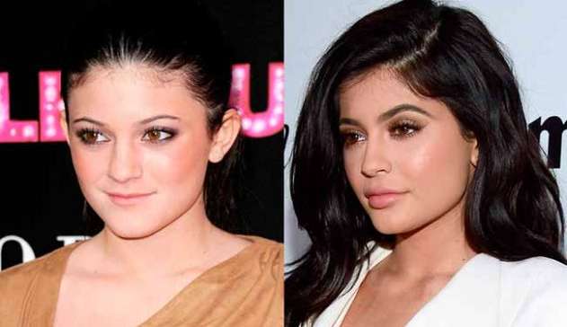 Kylie Jenner nega ter alterado seu rosto com cirurgias por insegurança   Lorena Bueri