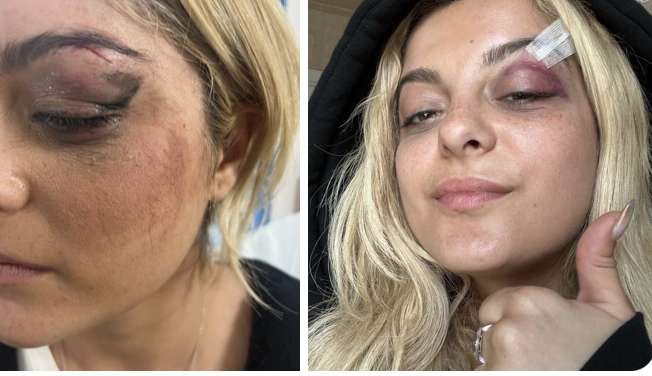 Celebridades mostram apoio a Bebe Rexha nas redes sociais após agressão Lorena Bueri