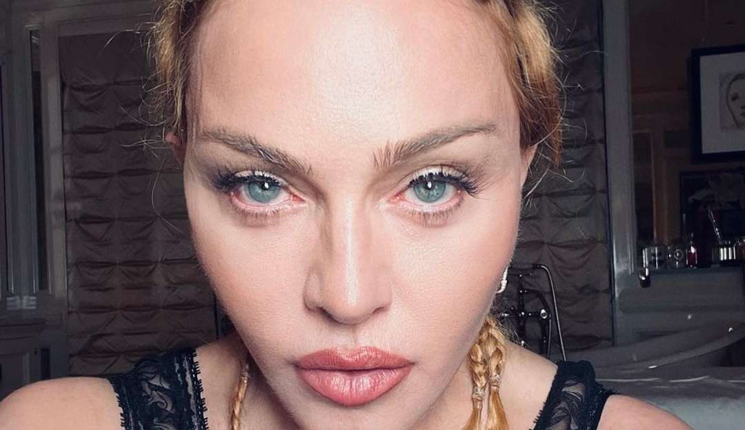Madonna recebe alta após internação por infecção bacteriana Lorena Bueri