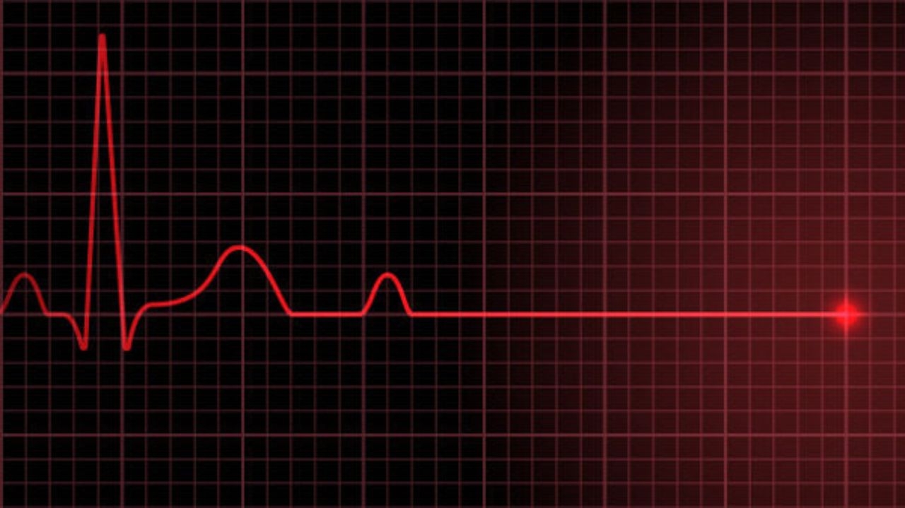 Estudo mostra que parada cardíaca pode dar sinais até 24 horas antes Lorena Bueri