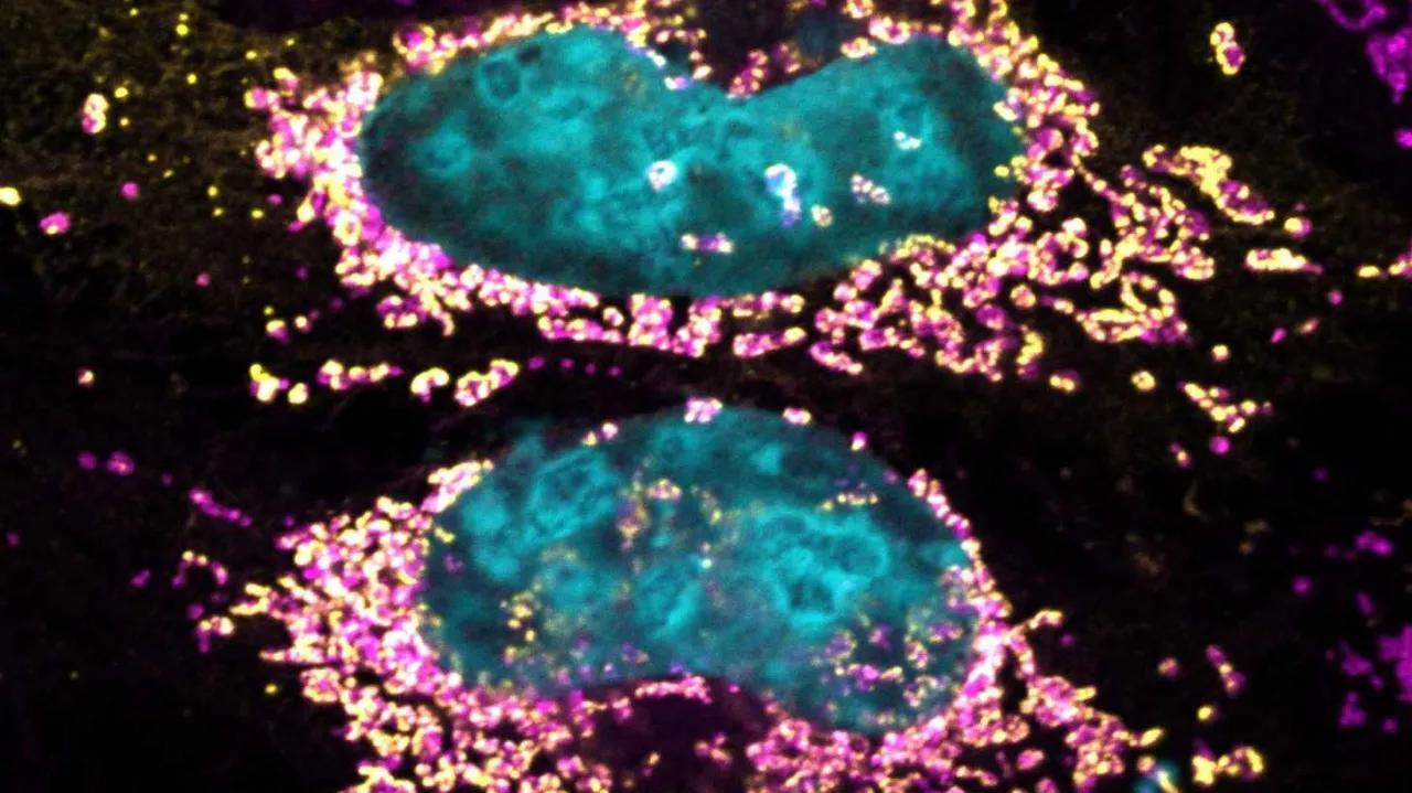 Cientistas descobrem proteína que prolonga a saúde de células humanas Lorena Bueri