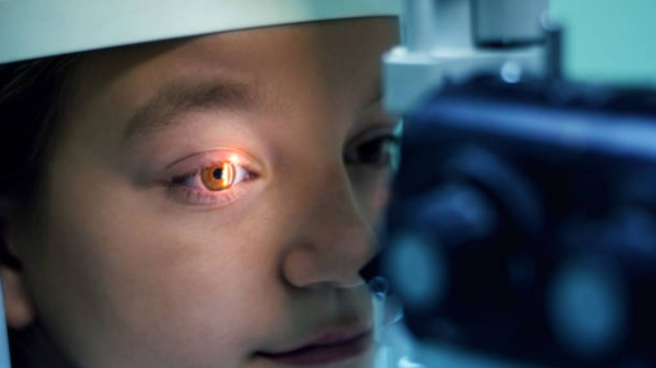 Cartilha conscientiza sobre diagnóstico e tratamento precoces do glaucoma infantil Lorena Bueri