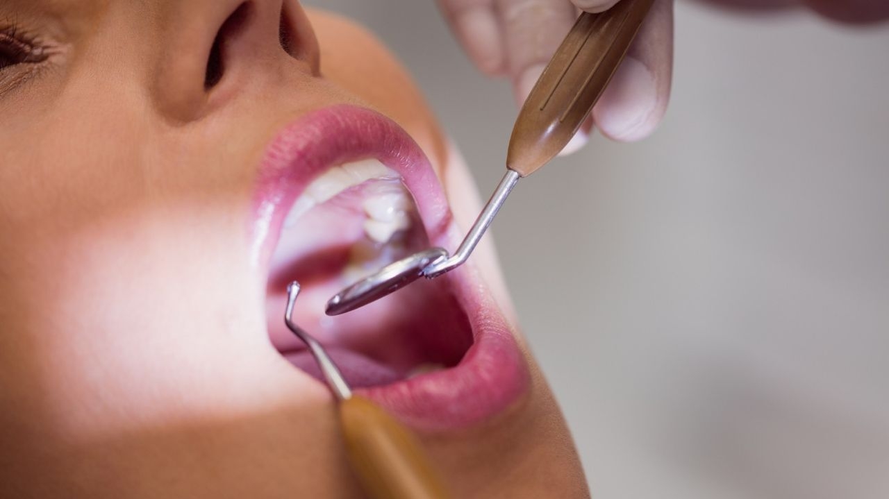 Câncer bucal: esteja alerta aos principais sintomas da doença Lorena Bueri