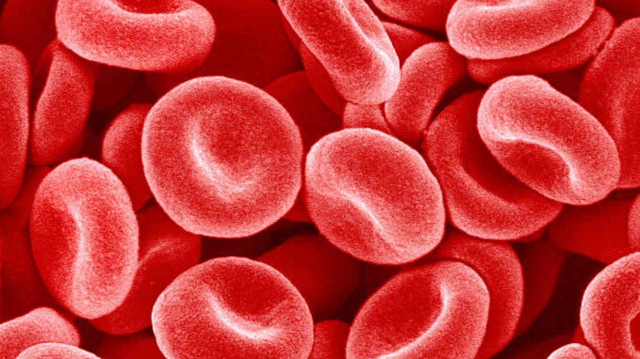 Hemofilia: conheça a doença que prejudica a coagulação do sangue Lorena Bueri