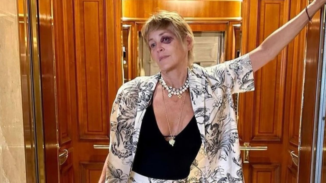 Sharon Stone reaparece e explica razão por trás do olho roxo Lorena Bueri