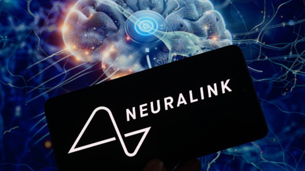 Elon Musk anuncia o sucesso do novo implante de chip cerebral em humanos Lorena Bueri