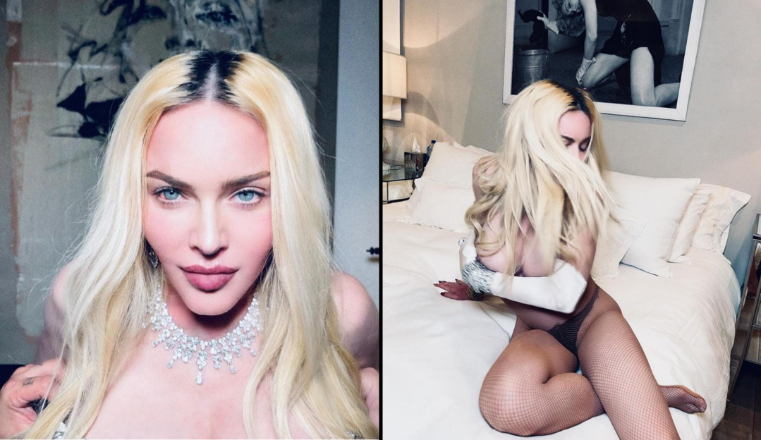 Madonna sensualiza nas redes sociais e posta fotos seminua Lorena Bueri