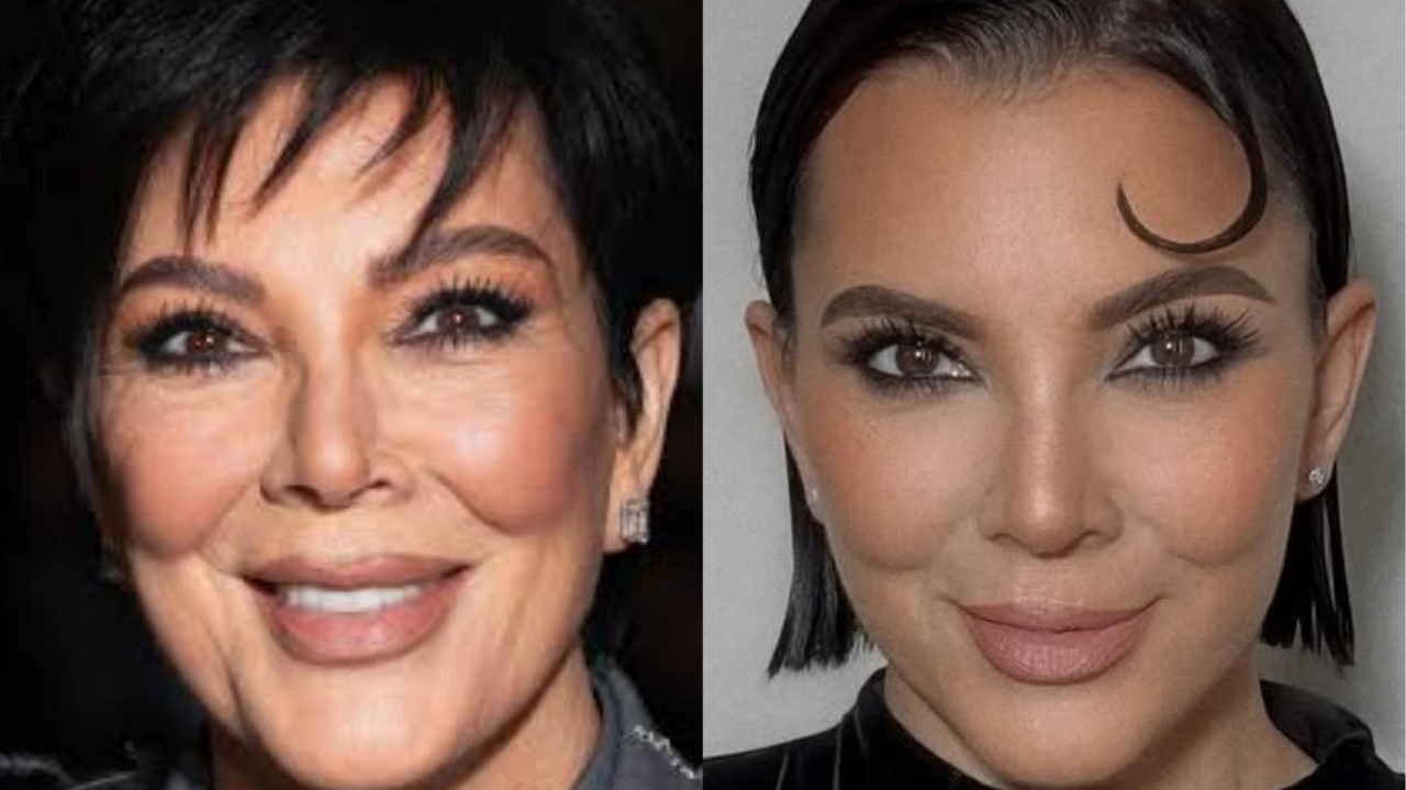 Kris Jenner desafia a idade aos 69: especialista explica como a estética regenerativa pode transformar um rosto maduro Lorena Bueri