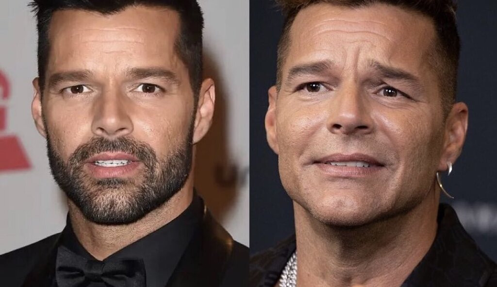 Ricky Martin assusta com nova aparência Lorena Bueri