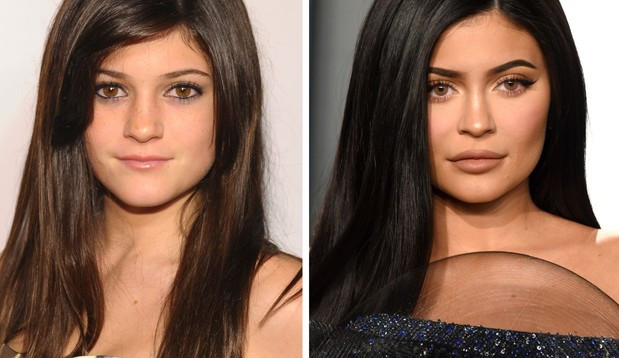 Descubra a evolução em beleza de Kylie Jenner 