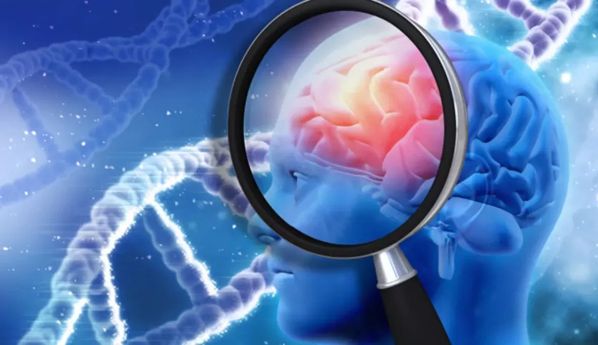 Descoberta brasileira pode impulsionar tratamento para evitar Alzheimer