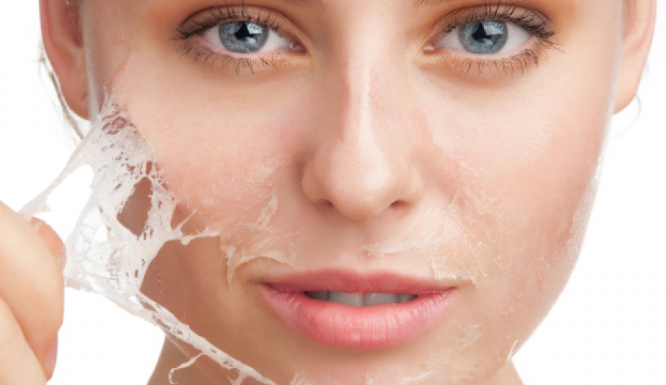 O peeling de fenol continua sendo um ótimo aliado da pele em alguns casos