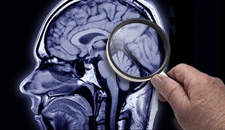 Vacina contra a gripe pode reduzir o risco de doença de Alzheimer em 40%, diz pesquisa
